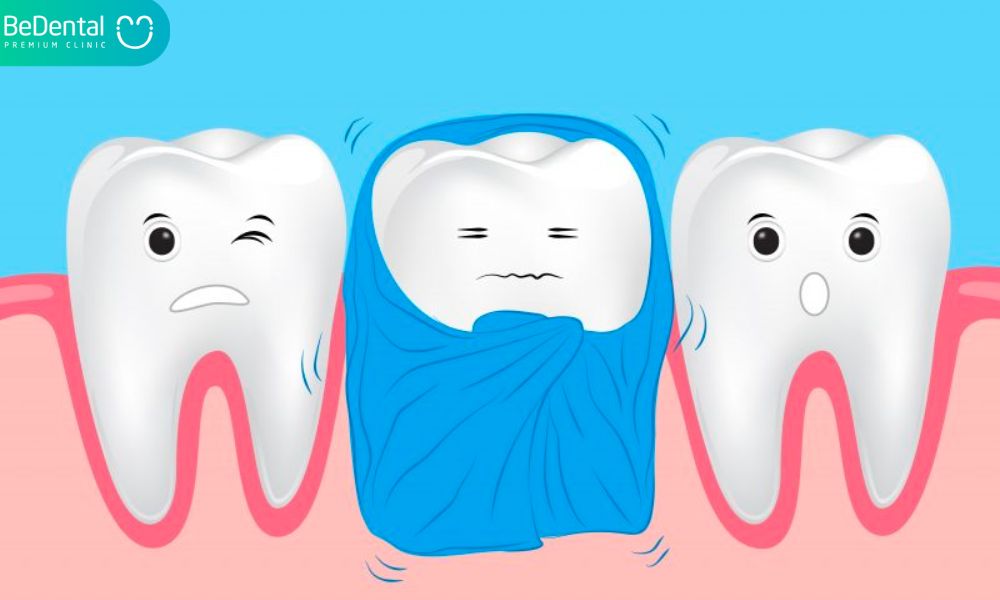 Tooth sensitivity symptoms