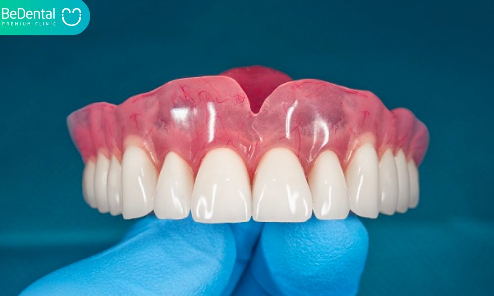 Complete dentures