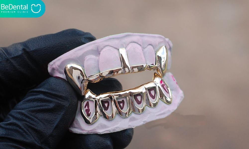 Grillz And 8 Things You Should Know – Be Dental