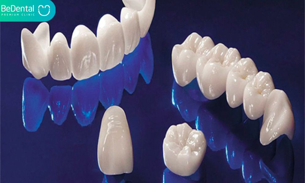 Zirconia bridge