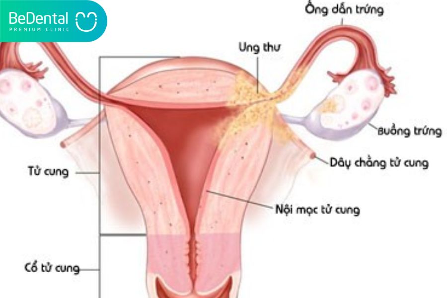 Hệ thống sinh sản của nữ giới