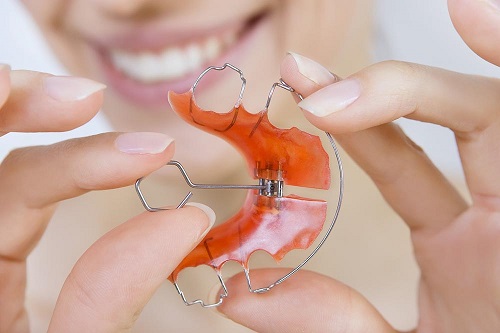  Hàm duy trì kim loại tháo lắp giúp cố định vị trí răng và tiết kiệm chi phí 