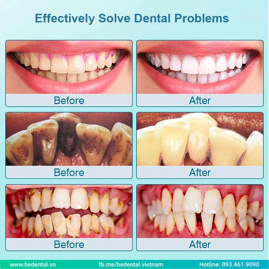 Effectively Solve Dental Poblems