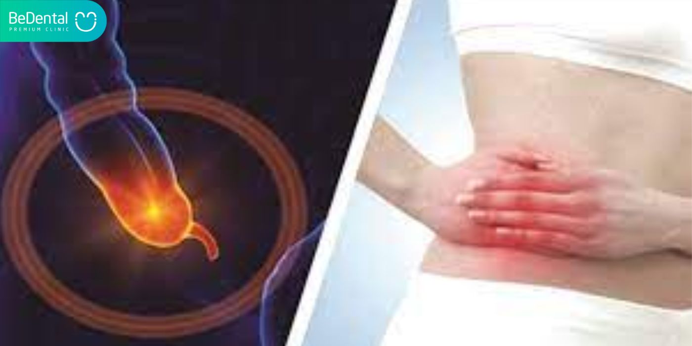 Đau bên phải bụng có thể là triệu chứng cảnh báo sớm bệnh viêm ruột thừa