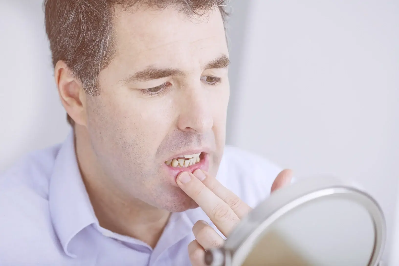 GSD Causes of Bleeding Gums Blog 1 1