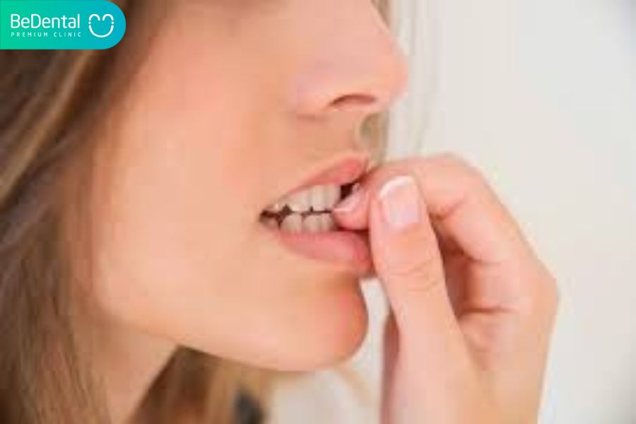 Mòn răng - Triệu chứng , nguyên nhân và cách điều trị 4 Mòn răng có thể bị gây ra bởi các tật xấu như cắn móng tay