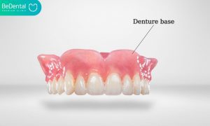 denture renewal