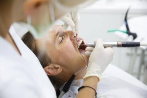 Có nên tiến hành bọc răng sứ sau khi lấy tuỷ không?