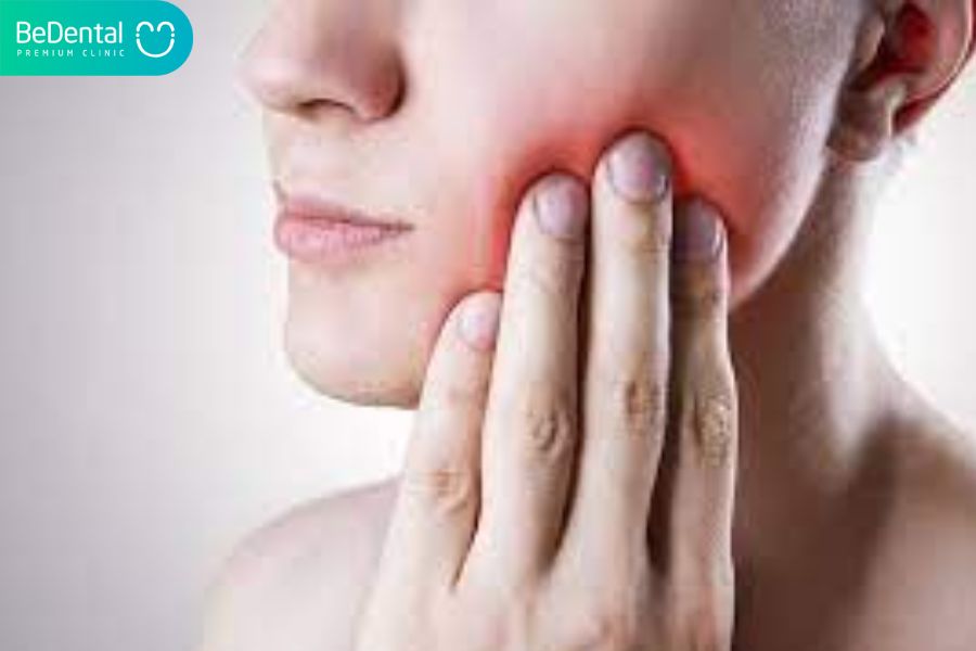 Răng khôn mọc ngầm mà gây đau nhức kéo dài nên được xử lí 