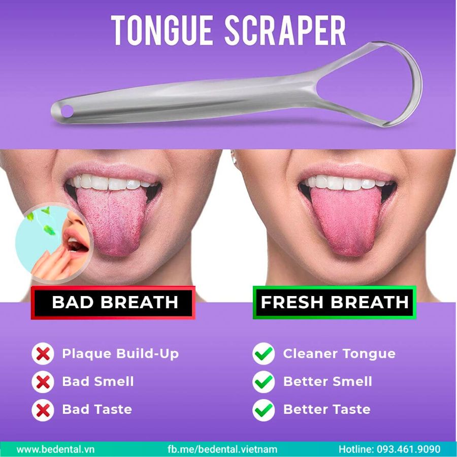 Tongue Scrapers: What You Need to Know