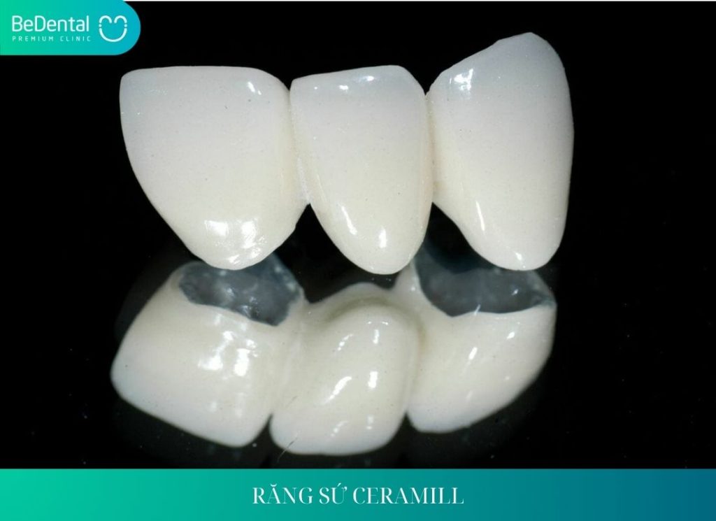 RĂNG SỨ CERAMILL