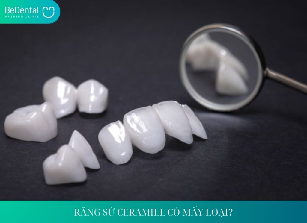 RĂNG SỨ CERAMILL CÓ MẤY LOẠI?