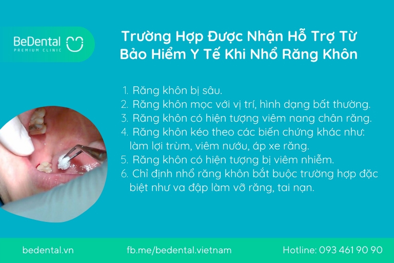 nho rang khon bao hiem y te 2