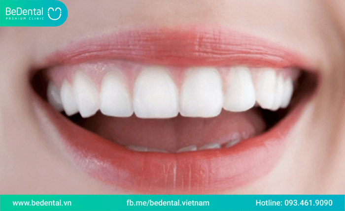 tẩy trắng răng giữ được bao lâu?khi nào nên tẩy trắng răng ?