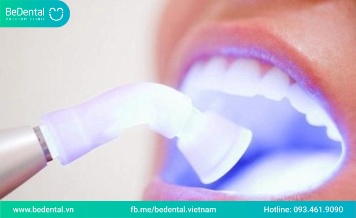 Các trường hợp tẩy trắng được và các trường hợp cần tránh tẩy trắng răng