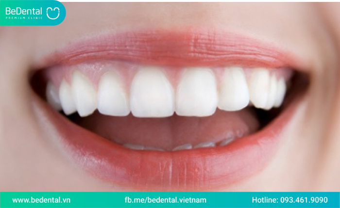 Răng chữa tuỷ tồn tại được bao lâu?Cách chăm sóc và bảo vệ răng sau khi chữa tuỷ 