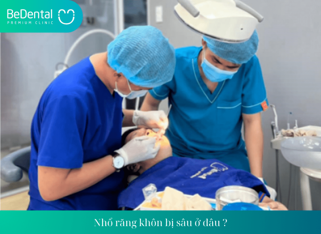 Sâu răng khôn là gì ?Dấu hiệu cho thấy sâu răng khôn