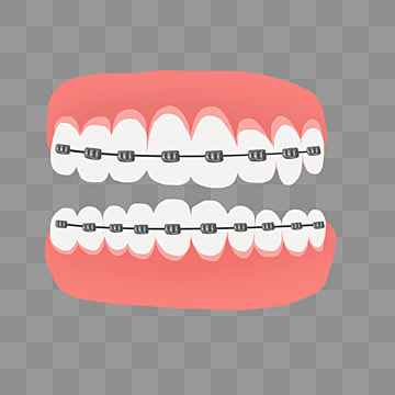 pngtree dental beauty braces gum medical beauty png image 3923534