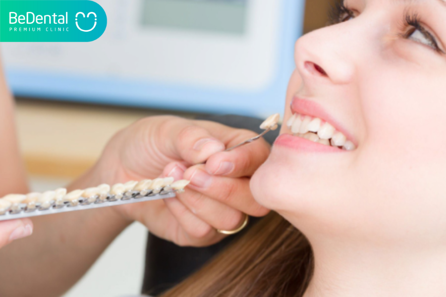 Bọc răng sứ bao lâu thì phải làm lại?