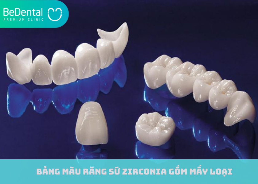 Bảng màu răng sứ Zirconia gồm mấy loại