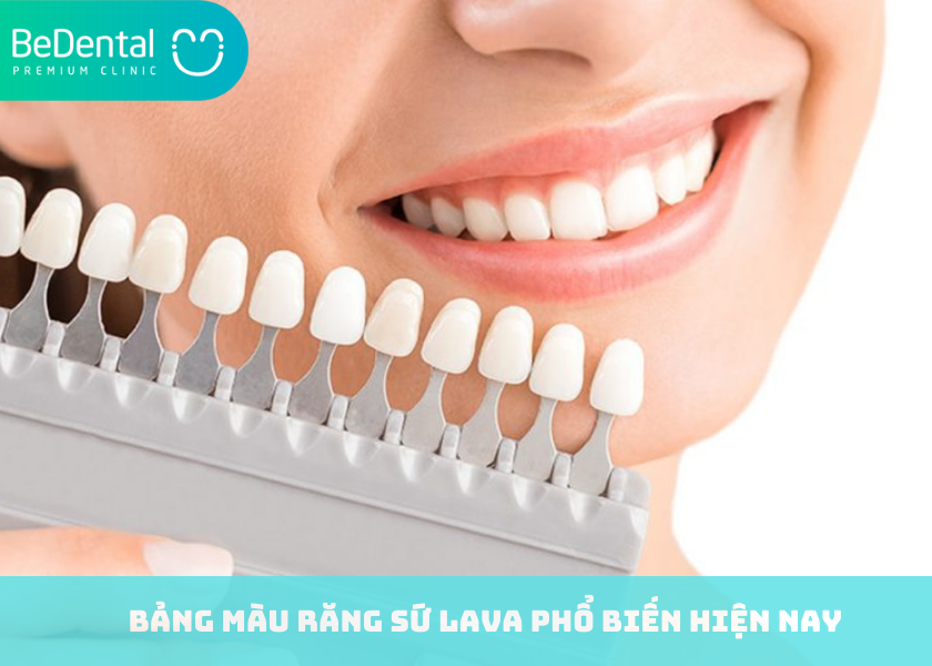 Bảng màu răng sứ Lava phổ biến hiện nay