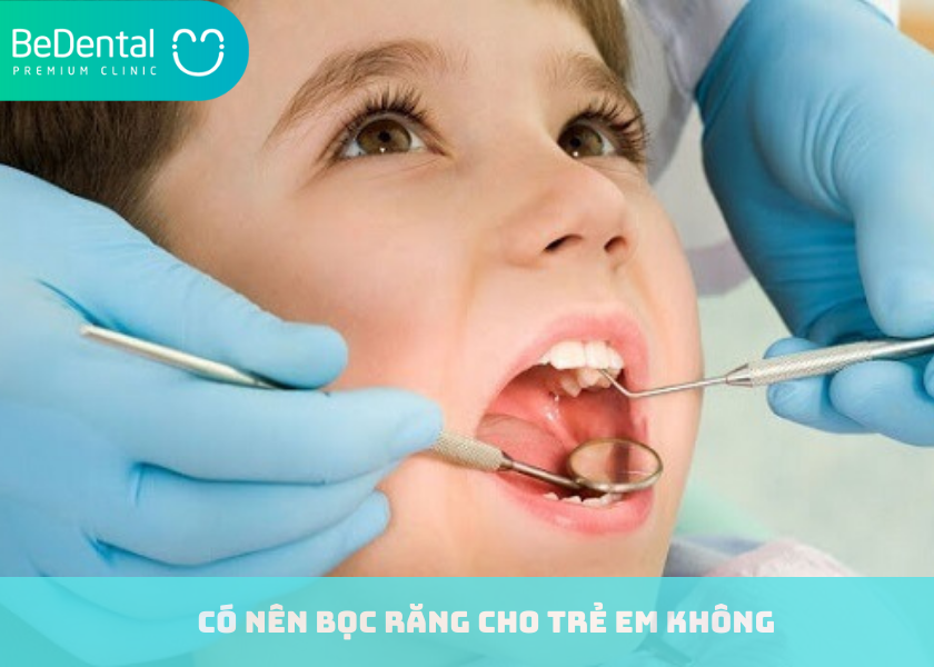 Có nên bọc răng cho trẻ em không ?