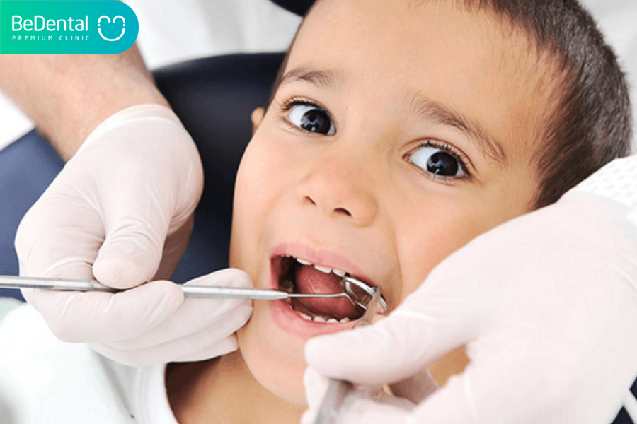 Có nên bọc răng cho trẻ em không?