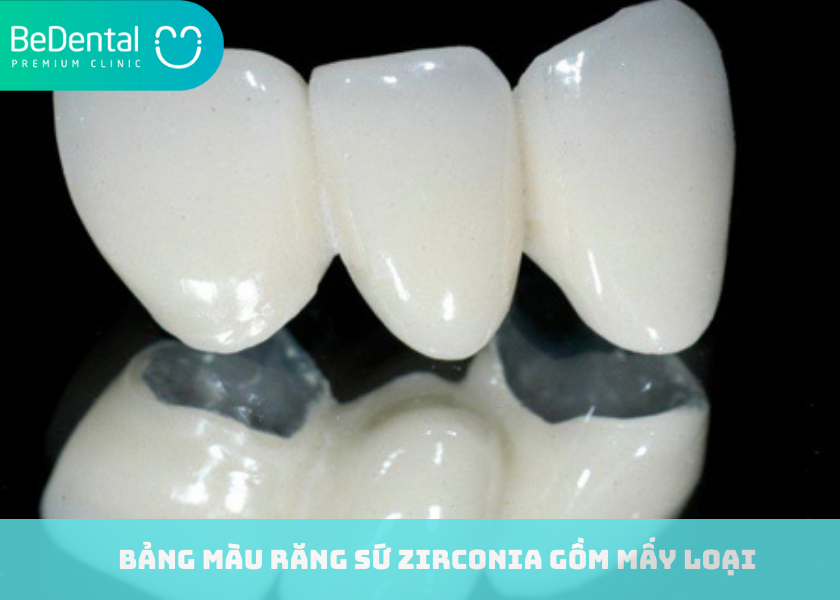 Bảng màu răng sứ Zirconia gồm mấy loại