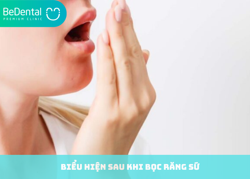 Biểu hiện sau khi bọc răng sứ