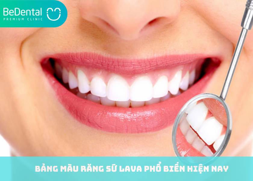 Bảng màu răng sứ Lava phổ biến hiện nay