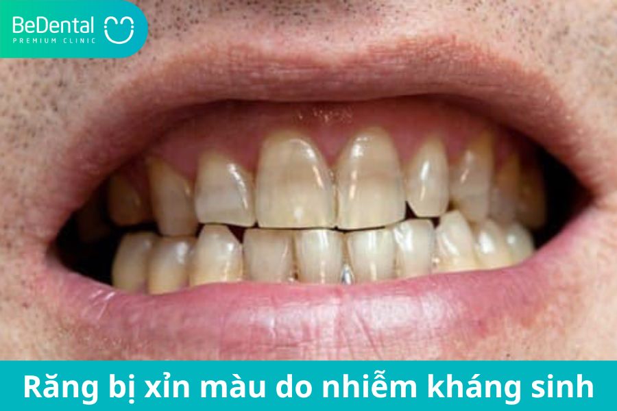 10 bệnh răng miệng phổ biến nhất