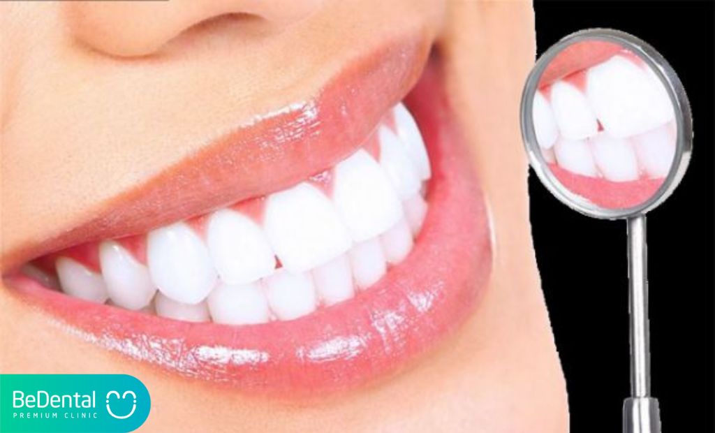 Công nghệ tẩy trắng răng có hiệu quả không?