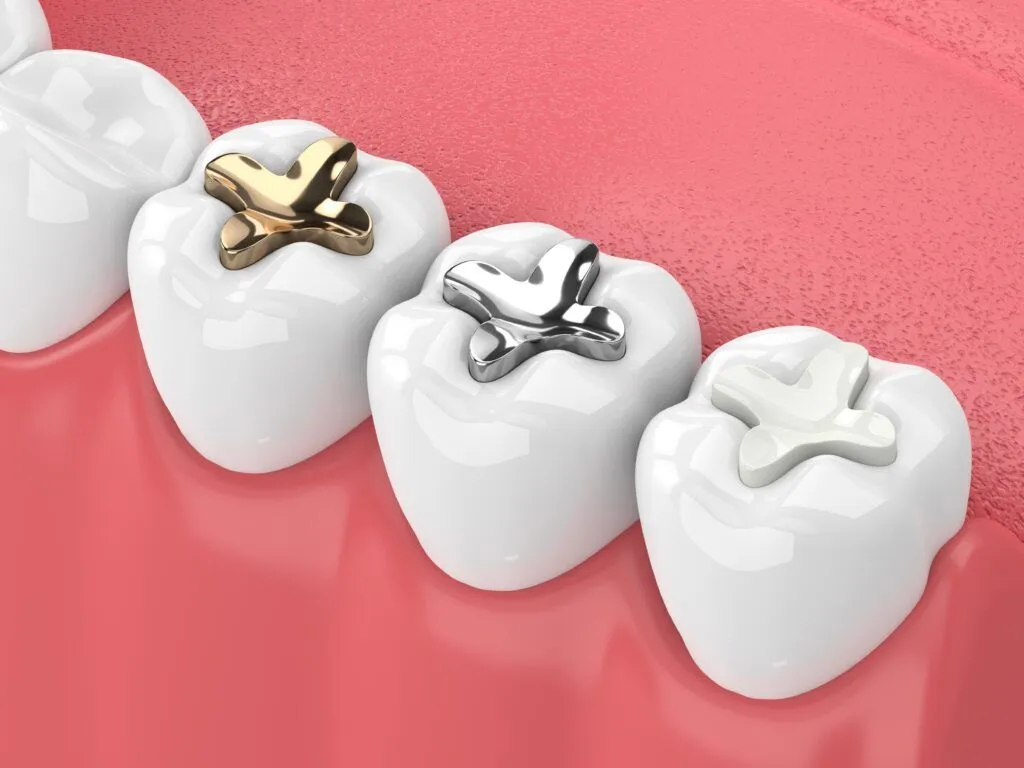 In what cases should tooth filling be performed? Reasons why you should get dental fillings? Which type of dental filling is good?