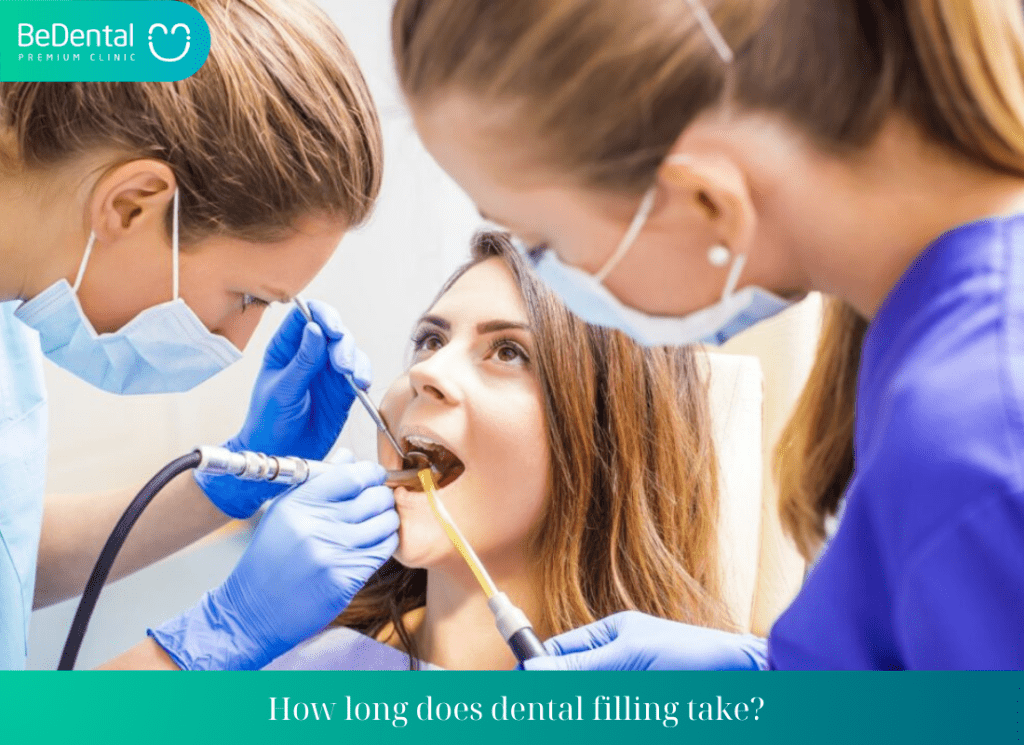 How long does dental filling take