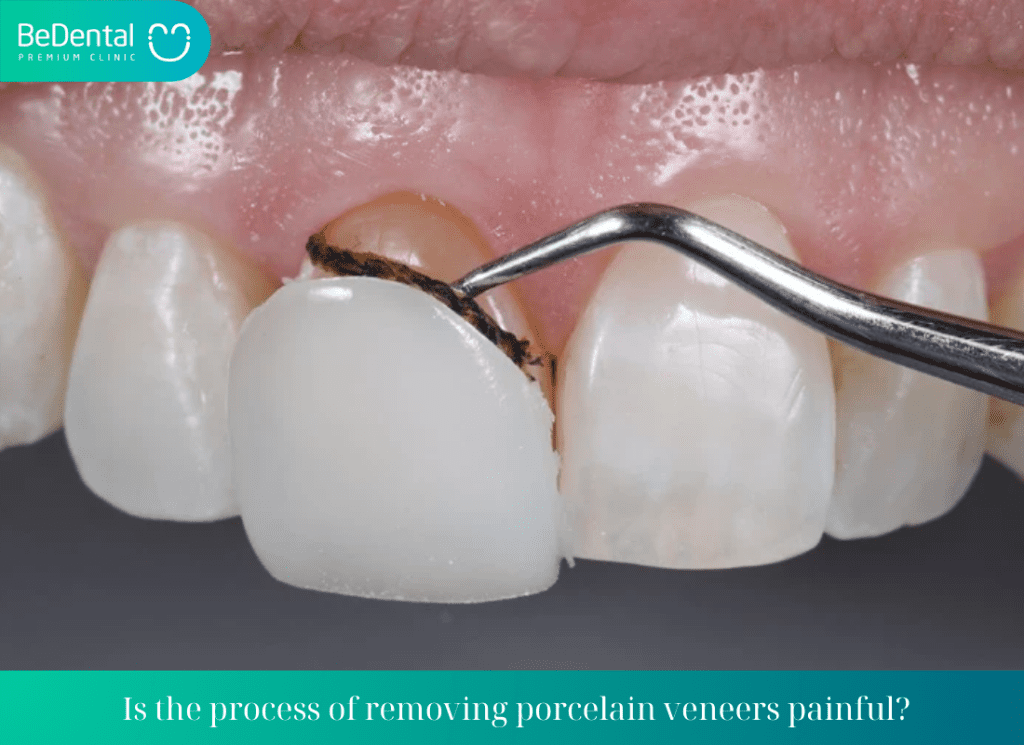 Is the process of removing porcelain veneers painful