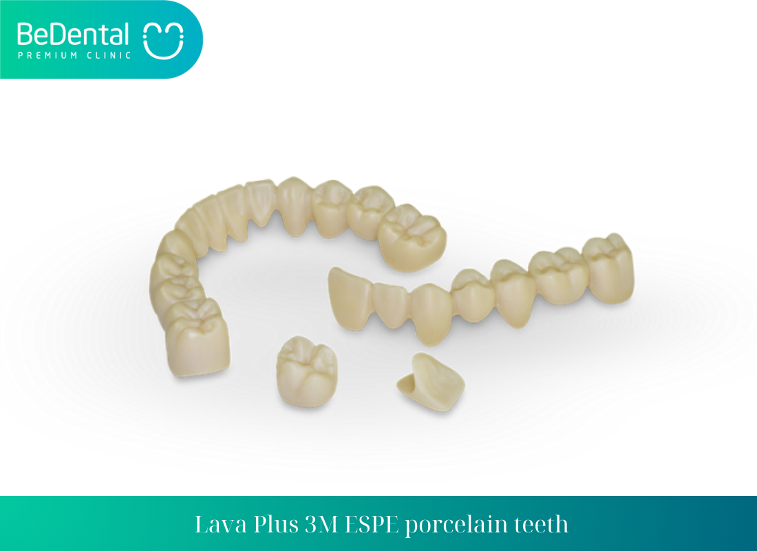 Lava Plus 3M ESPE porcelain teeth