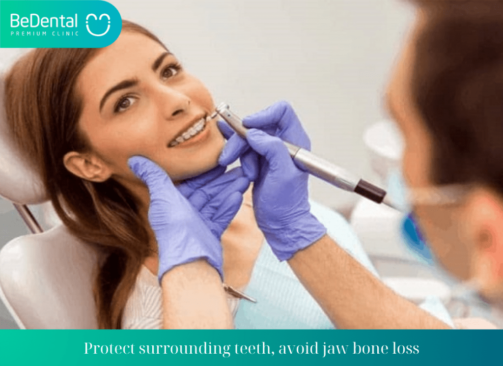 Protect surrounding teeth avoid jaw bone loss