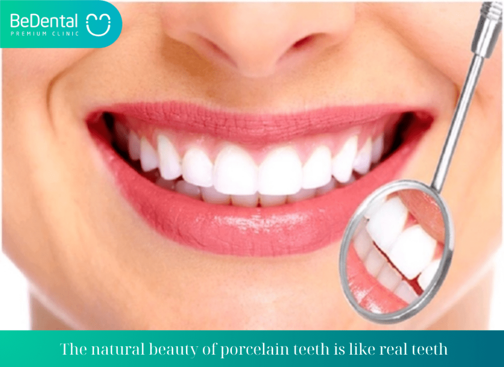 The natural beauty of porcelain teeth is like real teeth