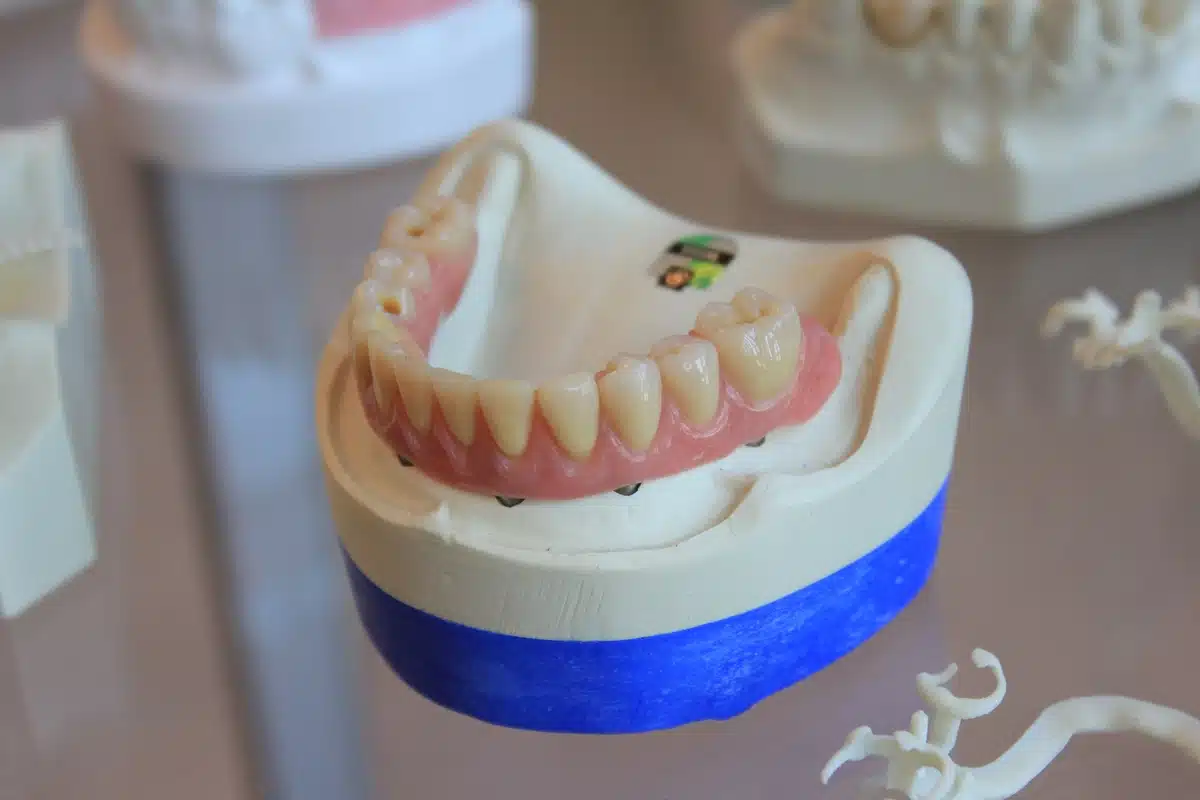 Causes of dentures fall out