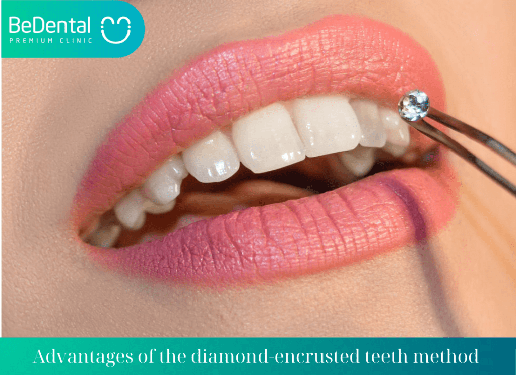 Advantages of the diamond encrusted teeth method 1