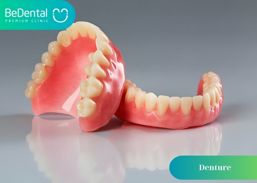 What are dentures? Causes of dentures fall out. Tips for taking care of dentures to avoid falling out