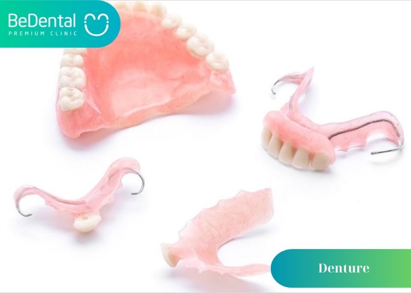 What are dentures? Causes of dentures fall out. Tips for taking care of dentures to avoid falling out