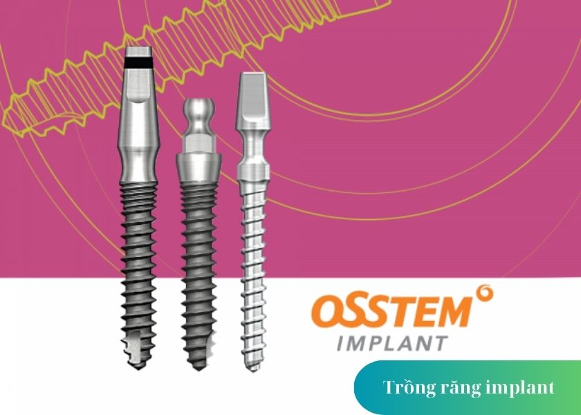 What is an Implant Osstem ?