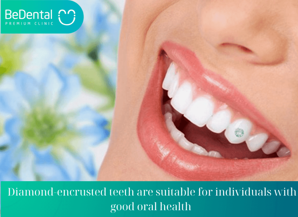 Should you get diamond encrusted teeth?