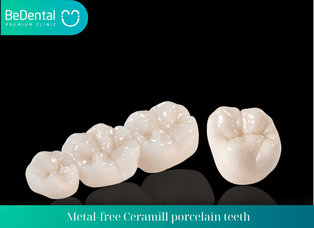 Metal free Ceramill porcelain teeth