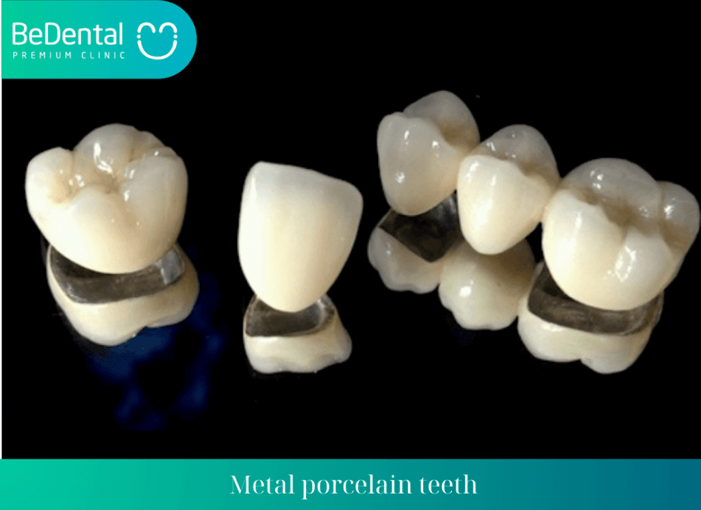 Common types of premium dentures