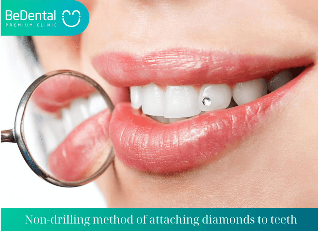 Non drilling method of attaching diamonds to teeth