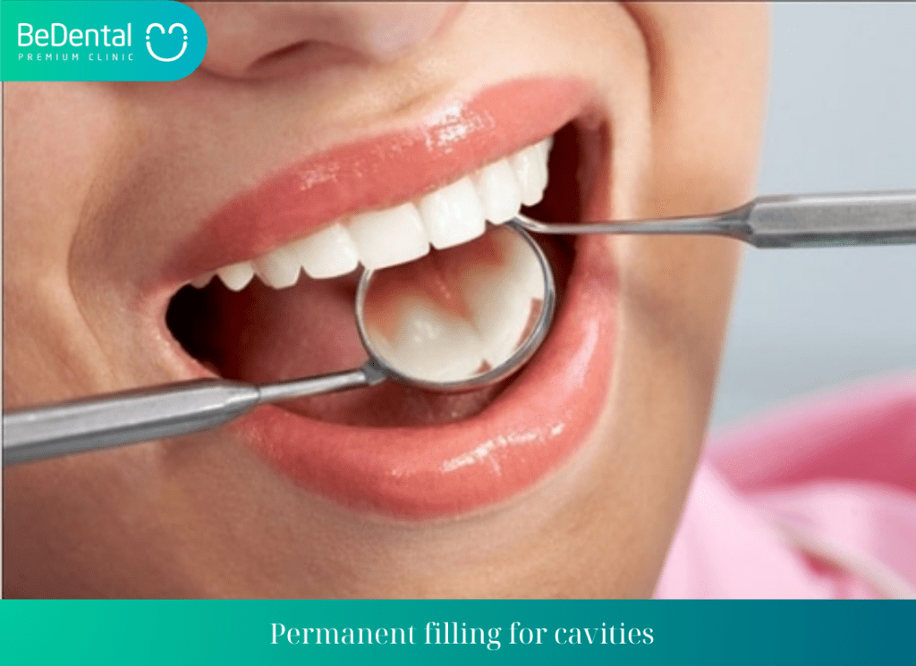 Permanent filling for cavities