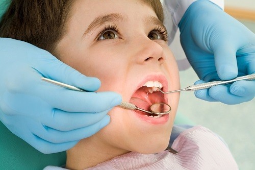 What to do when a 5-year-old has a cavity