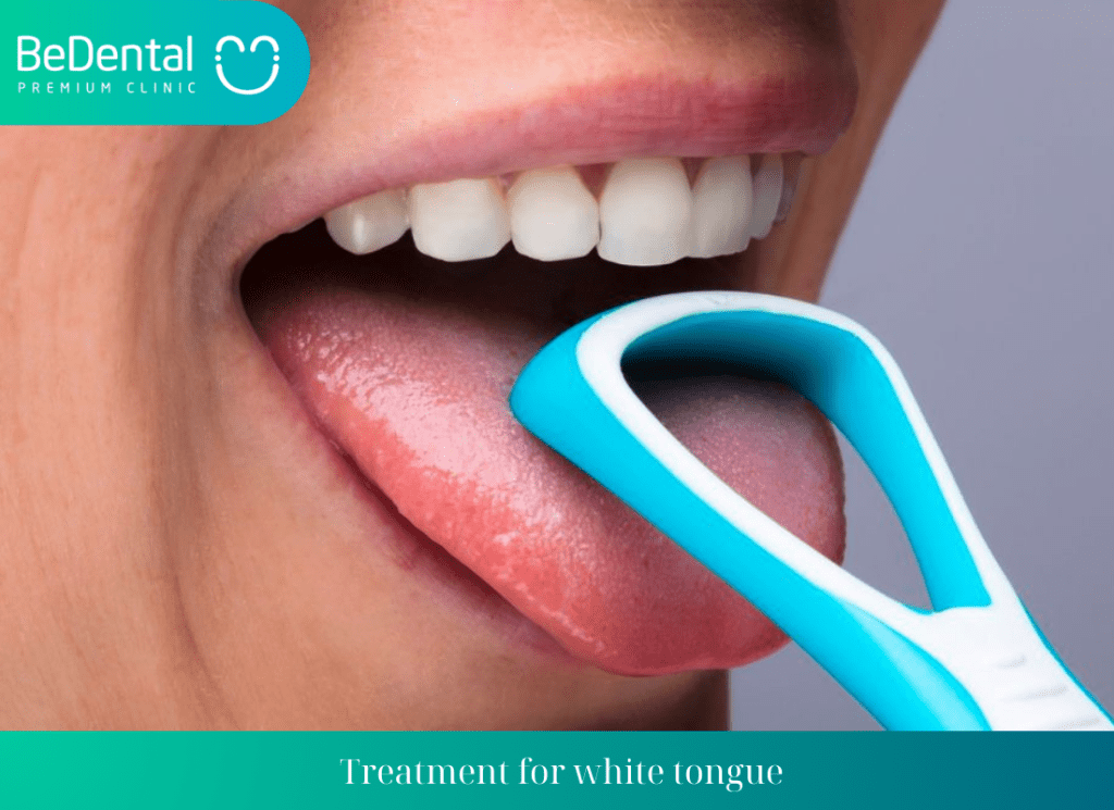 Treatment for white tongue